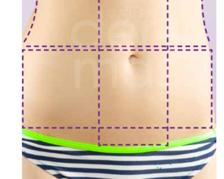 Depilación Abdomen inferior