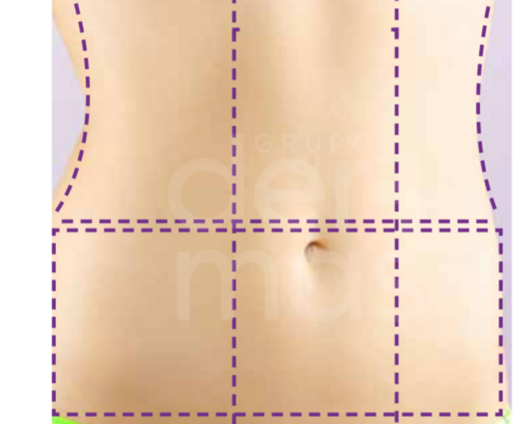 Depilación Abdomen Vertical