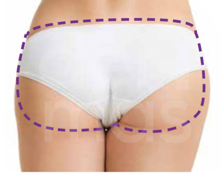 Depilación Glúteos