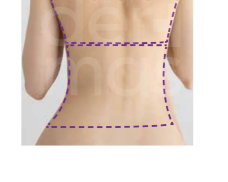 Depilación Media Espalda