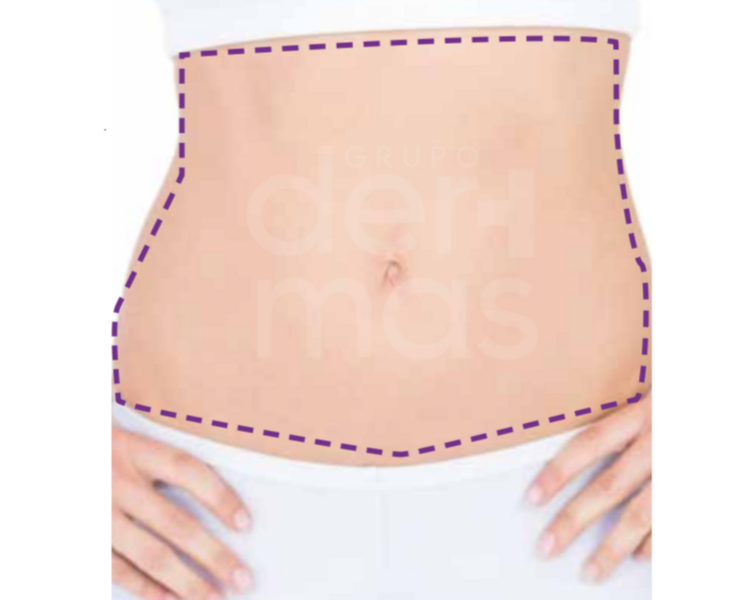 Depilación Abdomen Completo