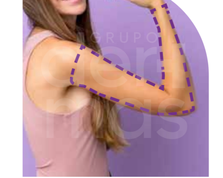 Depilación Brazos Completos