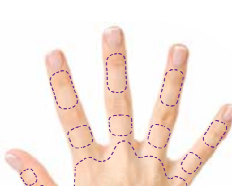 Depilación dedos manos o pies 