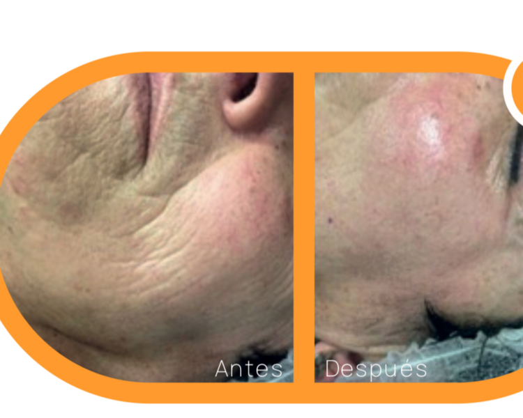 PB SERUM FIRMEZA Samartker facial