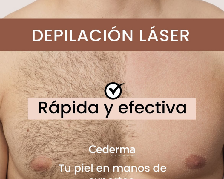 Depilación Pecho