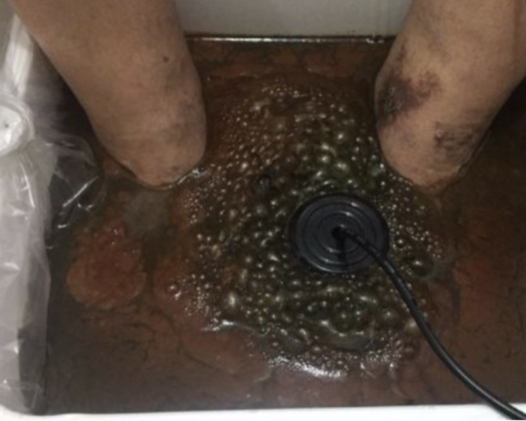 Desintoxicacion Podal