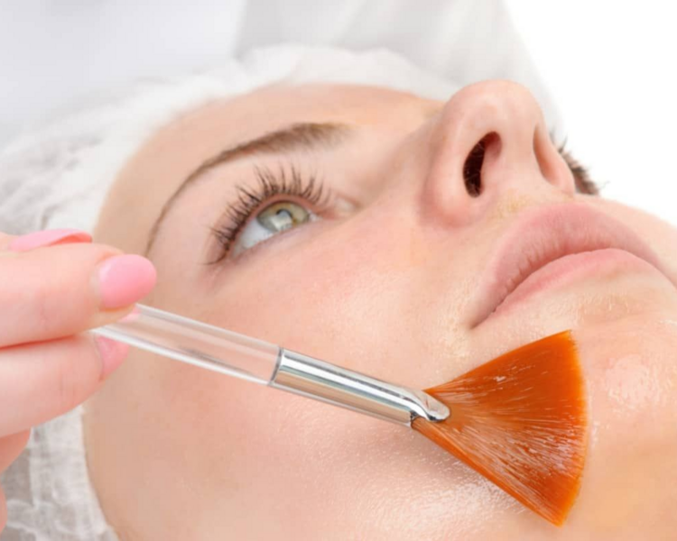 Peeling Quimico Invierno