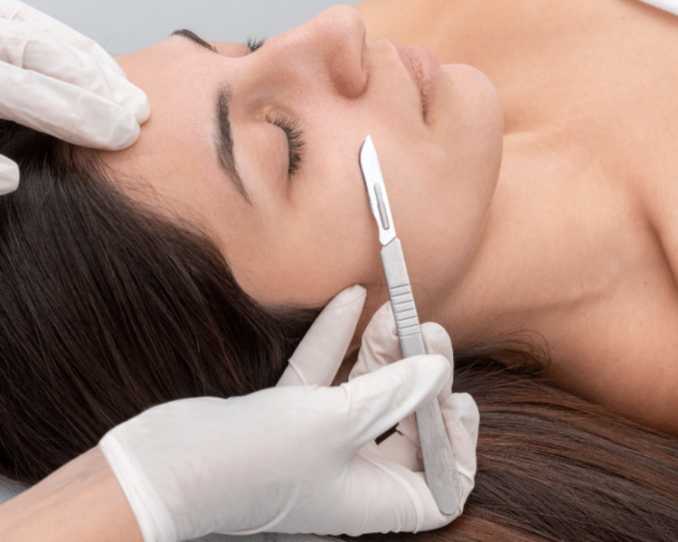 Dermaplaning