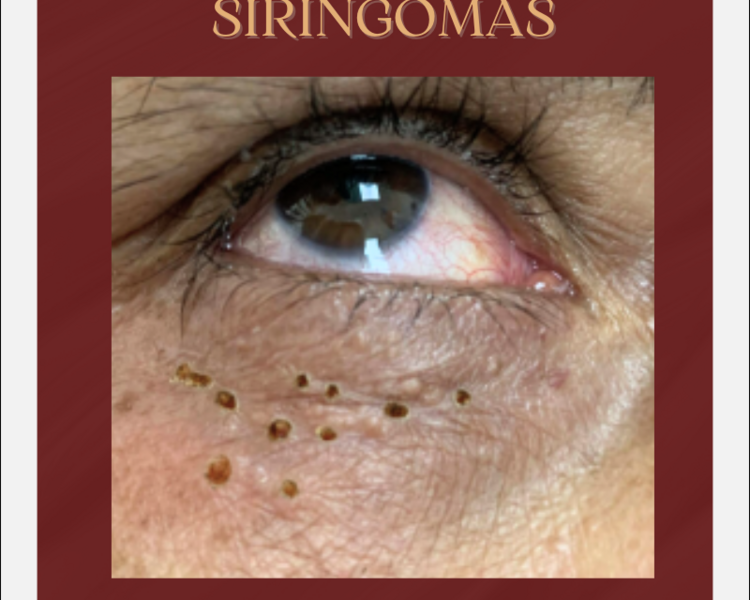 CAUTERIZACION DE VARIOS LUNARES - QUISTES O  VERRUGAS SESION 1 HORA