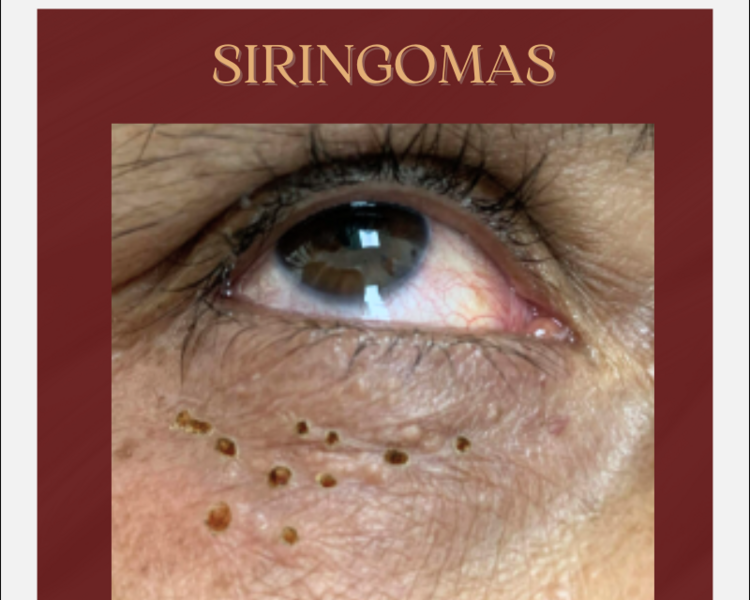 CAUTERIZACION DE 1 A 3 LESIONES 