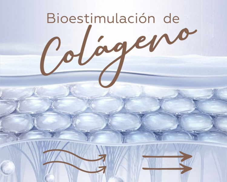 Bioestimulador del Colágeno Cuello (Sculptra)