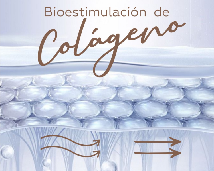 Bioestimulador del Colágeno - Rostro (Sculptra)