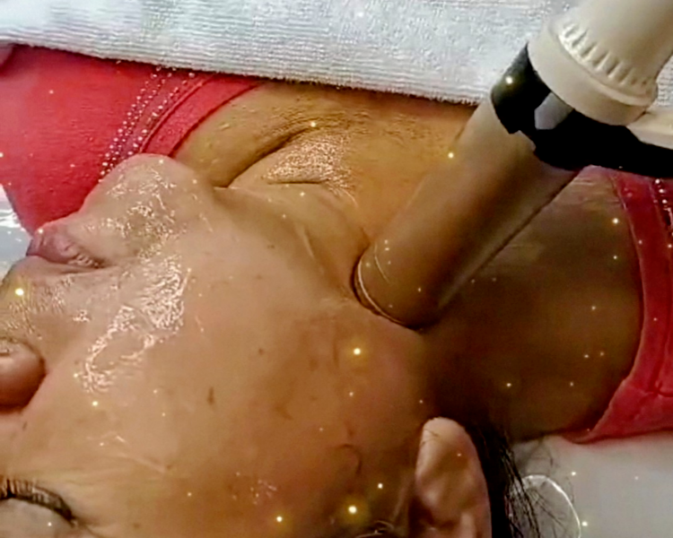 Hifu 12D (Cuello y Papada)