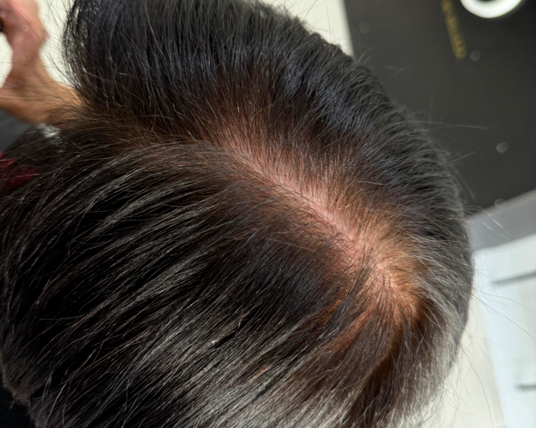 CUBRIMIENTO DE CANAS CABELLO CORTO. ( CRECIMIENTO 1-2 MESES)