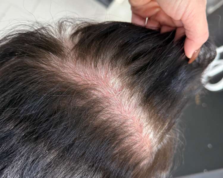 CUBRIMIENTO DE CANAS CABELLO LARGO-EXTRALARGO ( CRECIMIENTO 1-2 MESES)