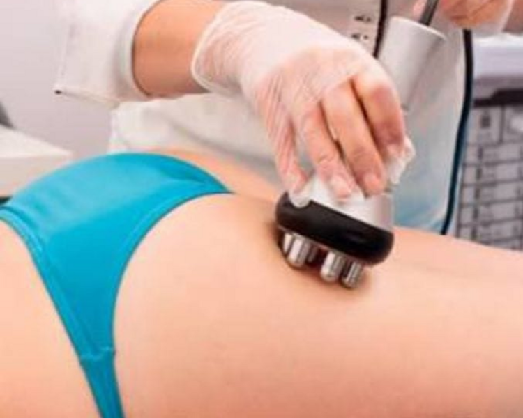 Radiofrecuencia Tripolar x zona Corporal