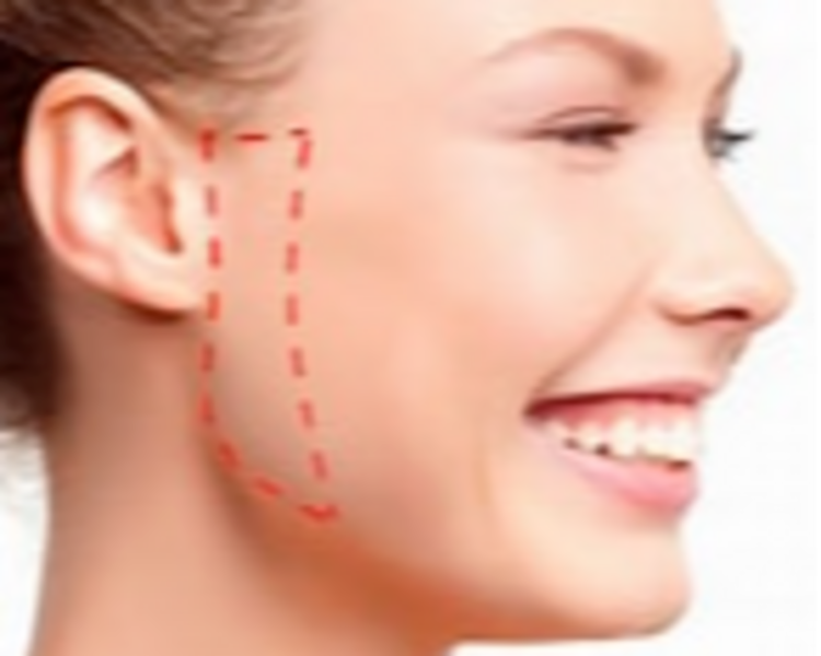 Zona a elegir: Frente, patilla, mentón, bozo, orejas o dedos ya sea de pies o de manos.