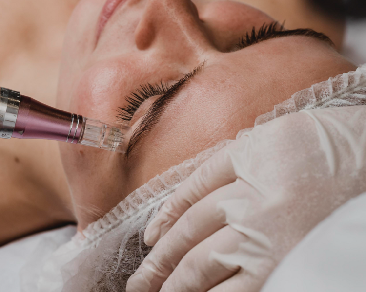 🌟Inducción de Colágeno ANTIEDAD