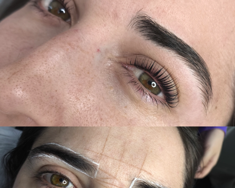 COMBO Lifting + Perfilado 