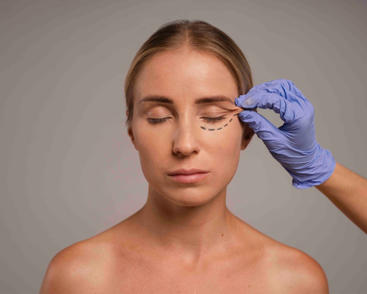 Botox + Hollywood peel