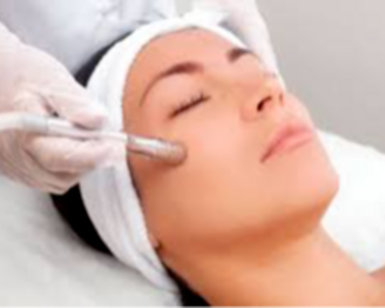 Limpieza Profunda + Peeling