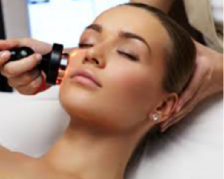 Sesión de Radiofrecuencia Facial