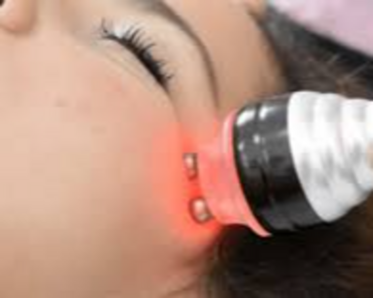 Full Líneas de Expresión / Arrugas (Dermaplaning + Radiofrecuencia)