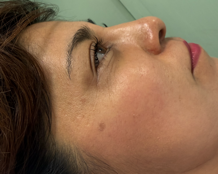 Lifting de Pestañas