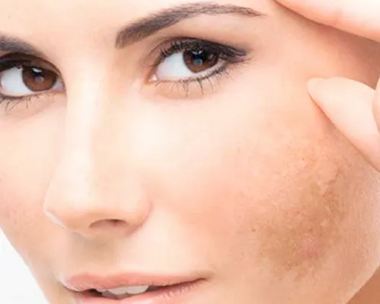 Tratamiento Facial Texturizante 