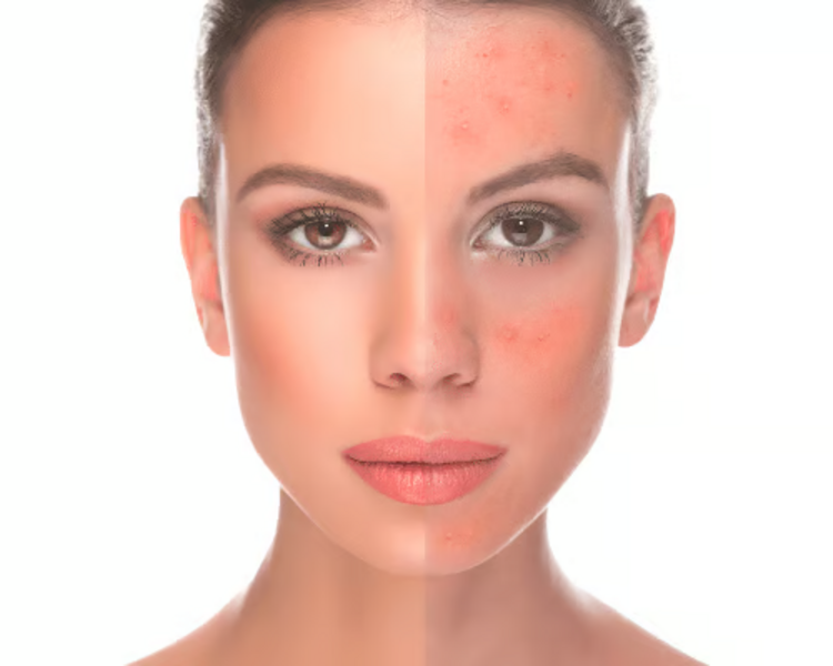 Tratamiento Facial Clásico Desensibilizante +18