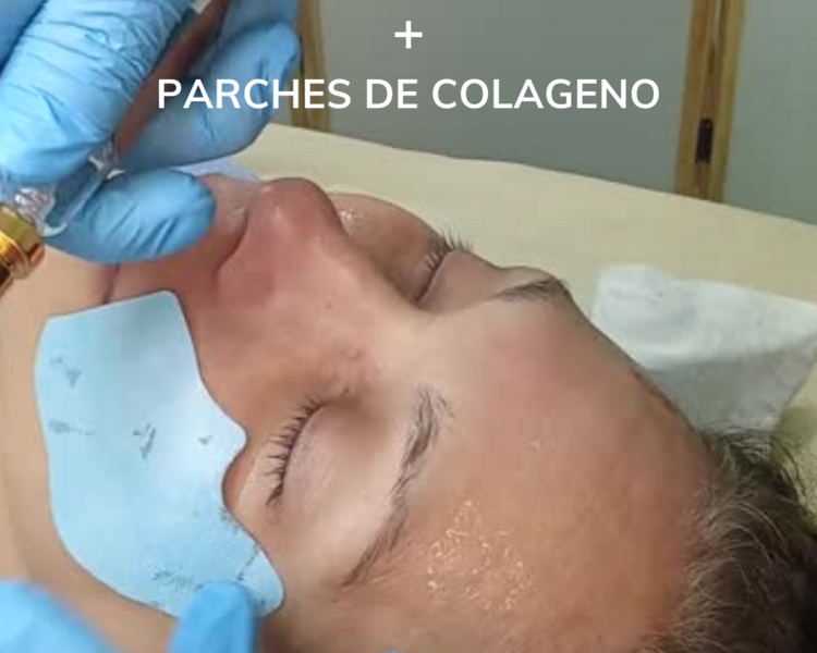 Tratamiento Gold Radiofrecuencia y Parches de colágeno
