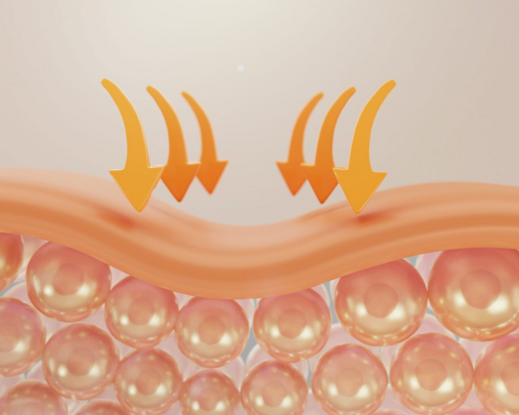 Tratamiento Facial Especializado Hilos Tensores + HiFu