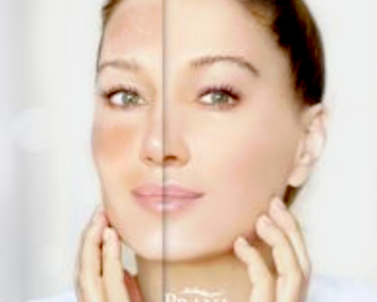 Tratamiento Facial Especializado Smoothie Aclarante + Exosomas