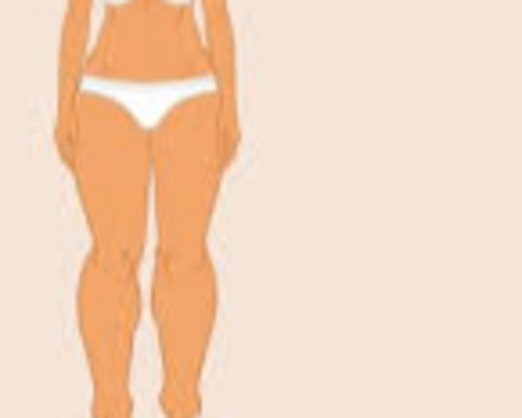 Lipedema Tratamiento 12 sesiones