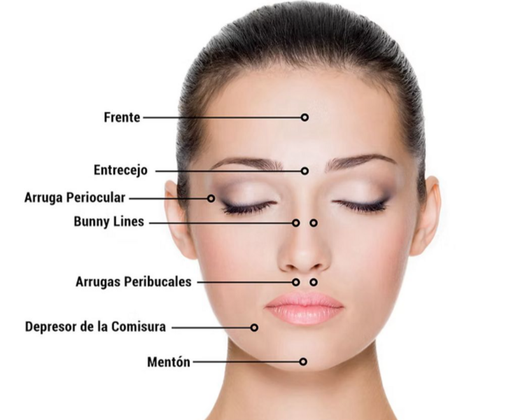 Toxina botulinica (Botox) 50 unidades 