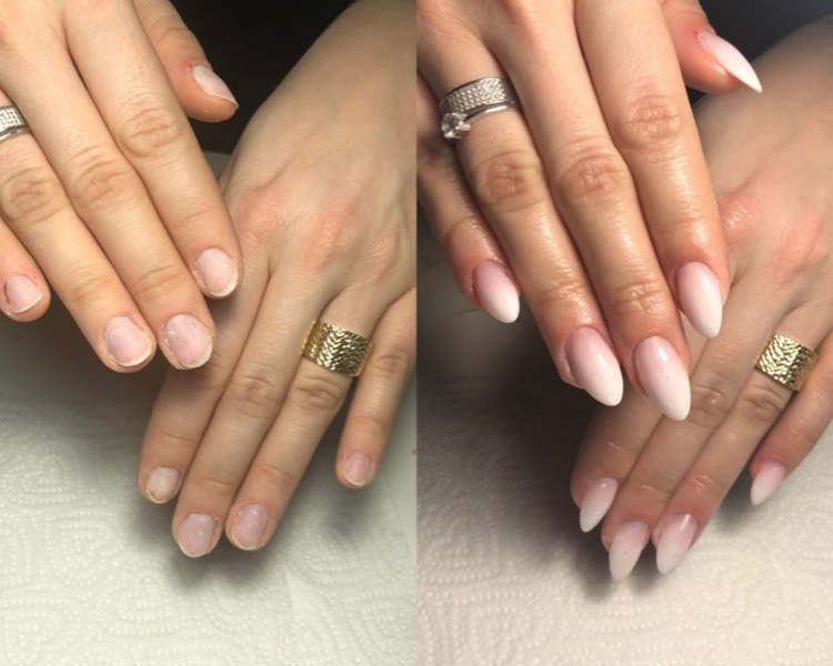 Extensión Softgel y retiro 