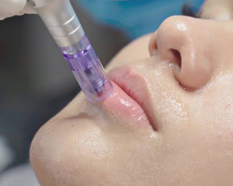 Hidratación Labial con ácido hialurónico 