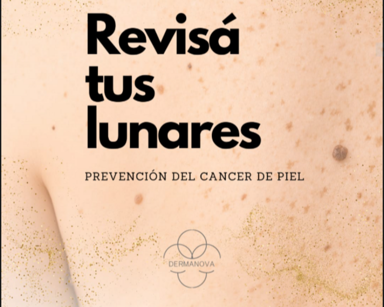 Dermatoscopía manual