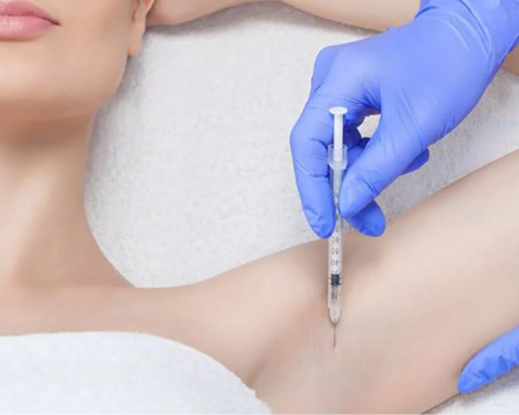 Tóxina Botulínica/Hiperhidrosis