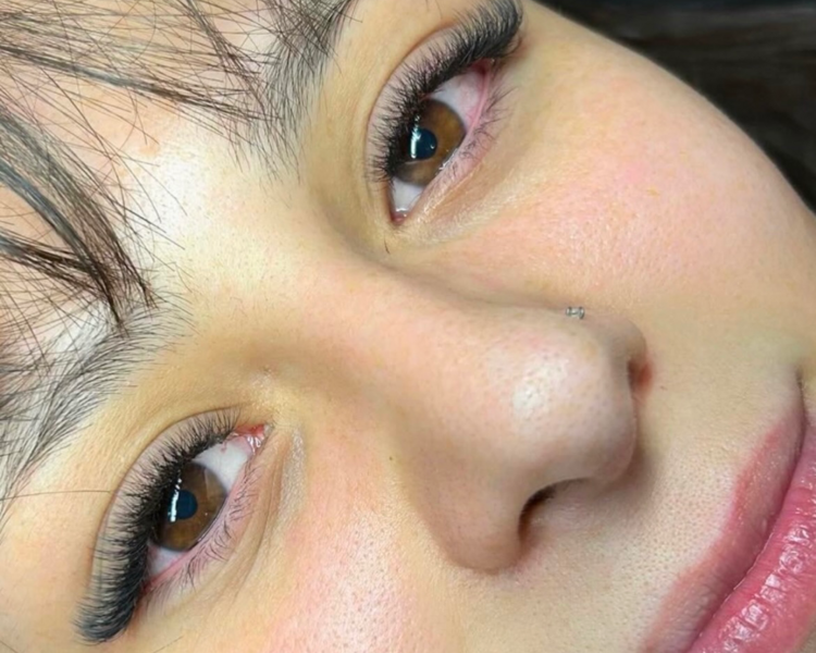 Capping (retención +40 días)