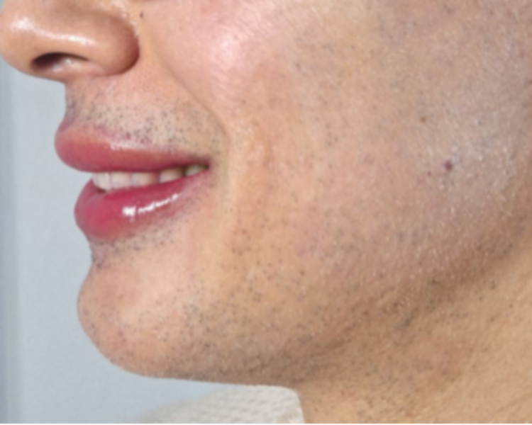 Reserva Hora Micropigmentación Labios