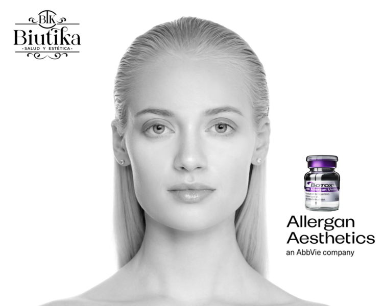 Botox (3 zonas) - Tercio superior