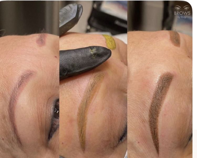 Neutralización de cejas 