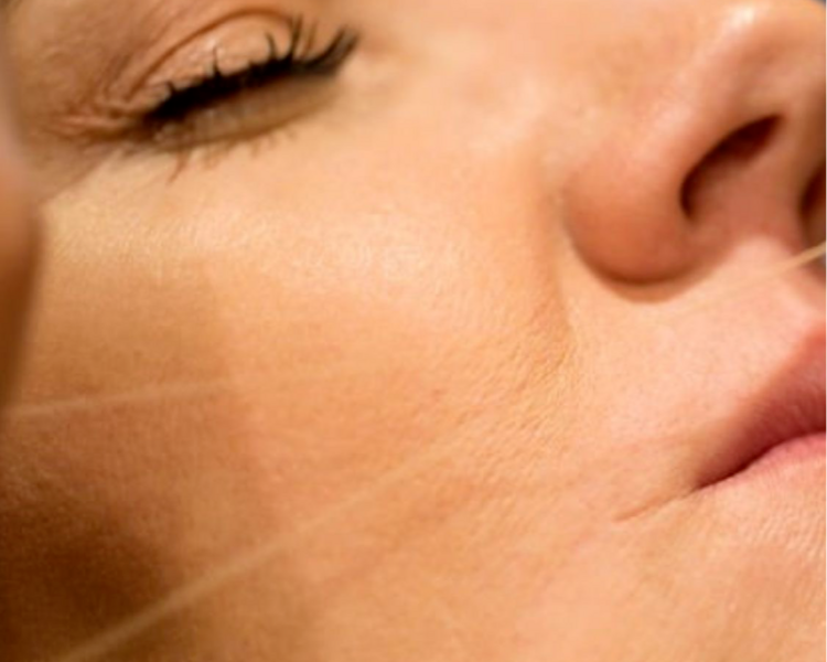 Depilación de bozo con hilo