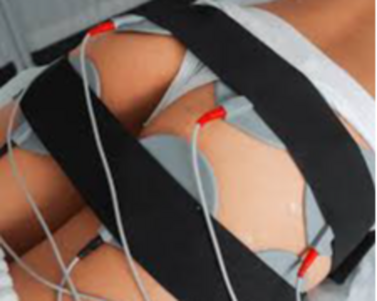 7 SESIONES LEVANTAMIENTO Y REAFIRMACION GLUTEOS