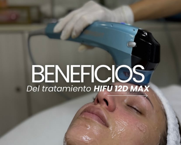 Hifu 12D Max (rostro completo + cuello + escote )