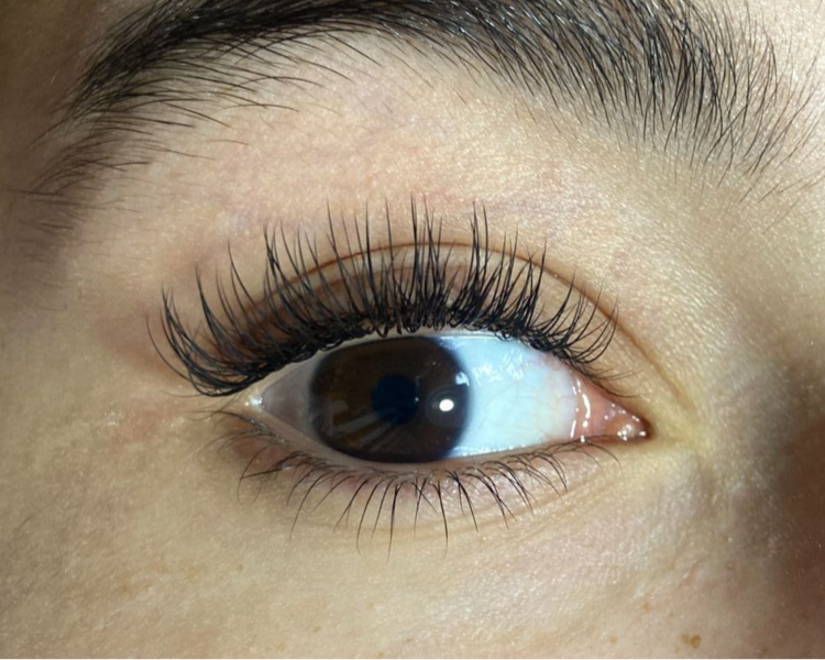 Extensiones clásicas PxP