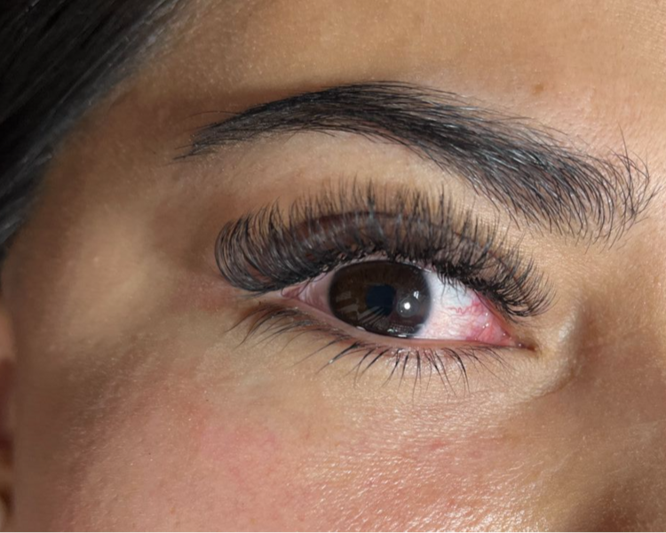 Extenciones volumen medio