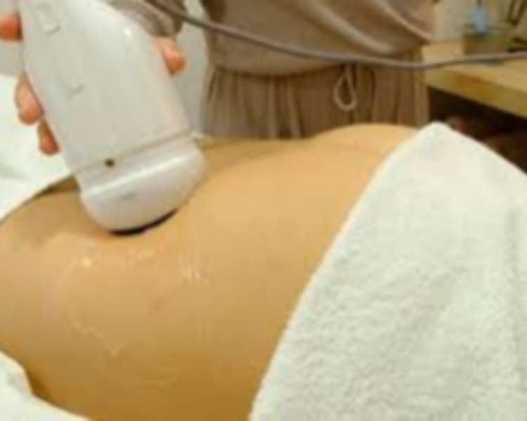 Liposonix + Maderoterapia