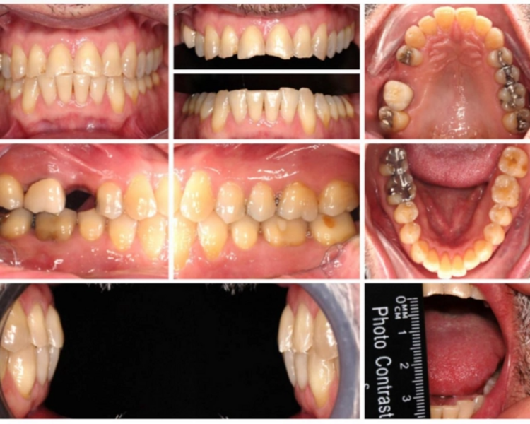 FOTOGRAFIA PROSTODONCIA